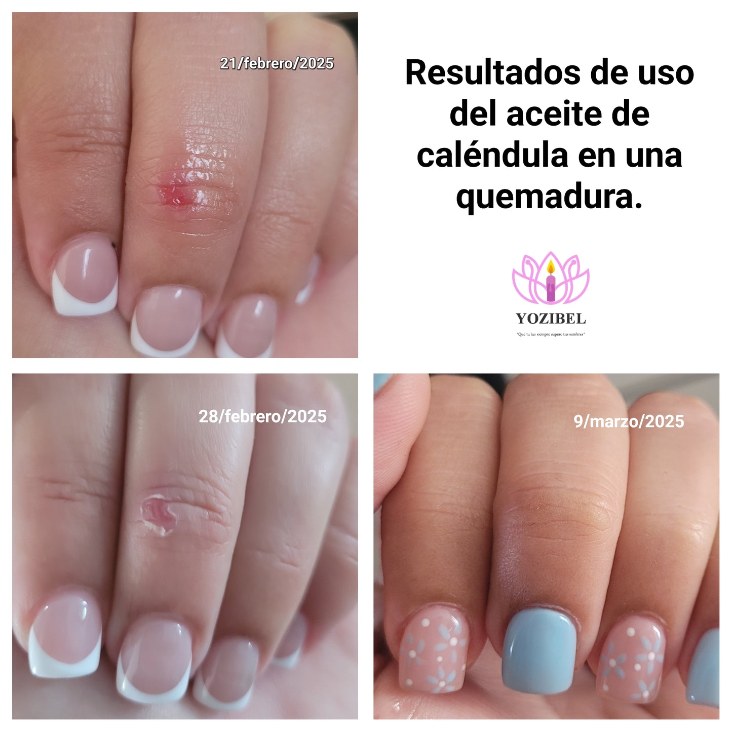 Calendula Oil Roller